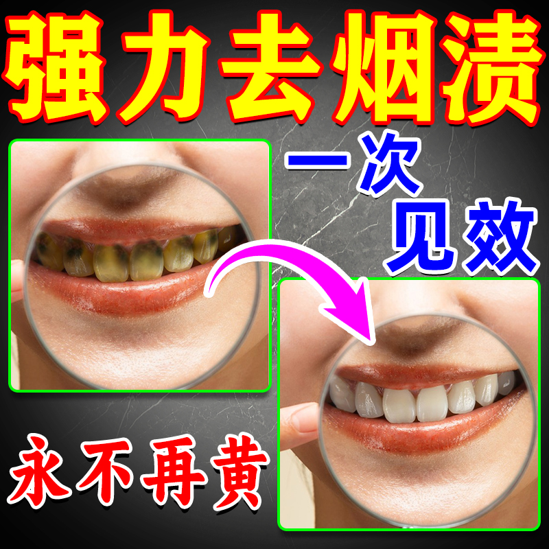 【日本进口】强力去烟渍牙膏牙菌斑祛除神器结石牙渍一擦即除牙膏