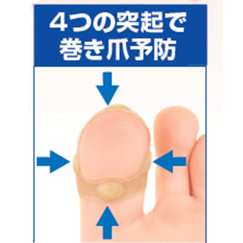 极速日本指甲矫正器嵌甲脚指甲修正趾甲长肉里贴正甲脚沟炎套装拉