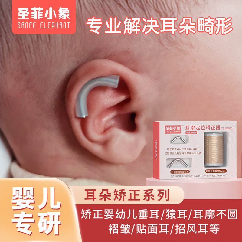 宝宝耳廓定型新生的儿耳朵矫正器婴儿招风耳硅胶贴儿童纠正矫形器